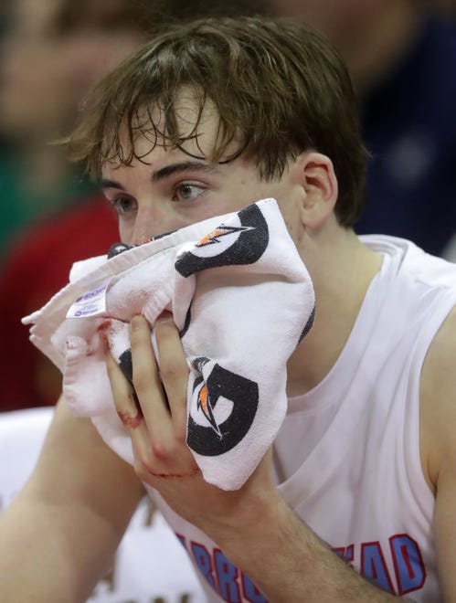 Arrowhead High School's Bennett Basich (14) after being struck in the mouth against Neenah High School in a Division 1 semifinal game during the WIAA state boys basketball tournament on Friday, March 15, 2024 at the Kohl Center in Madison, Wis. Arrowhead defeated Neenah for 99-95 in four overtimes.
Wm. Glasheen USA TODAY NETWORK-Wisconsin